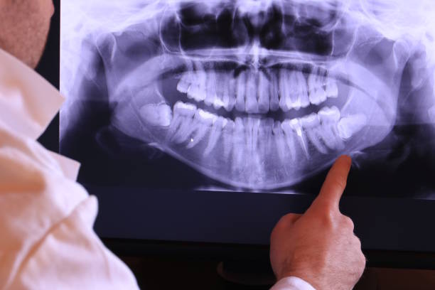 Best Emergency Care for Gum Disease in Waterford, WI