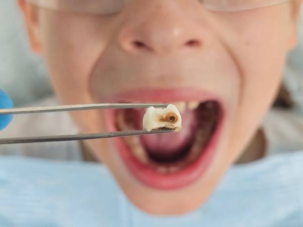 Best Walk-In Emergency Dental Services in Waterford, WI